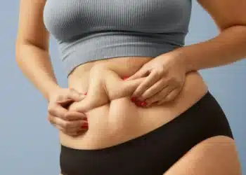Bariatric Surgery