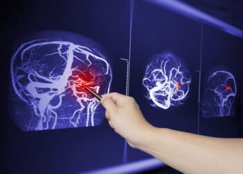 Traumatic Brain Injuries